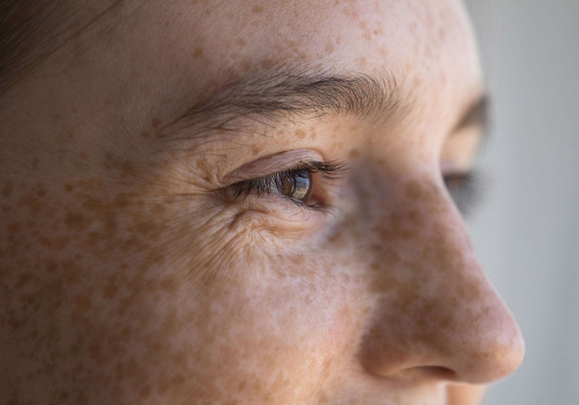 Gros plan du contour des yeux d'une femme avec taches de rousseur